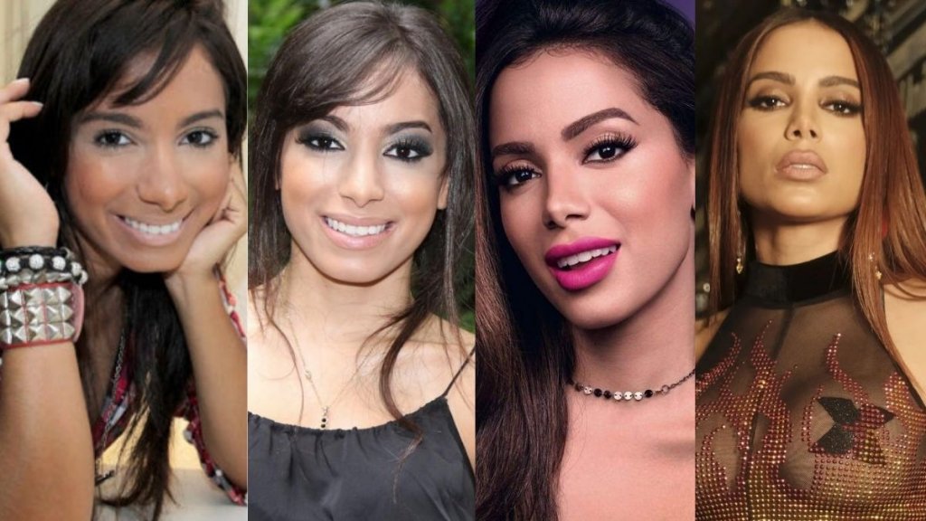 Anita antes e depois